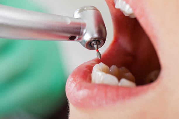 Best Weekend Emergency Dentist in Blaine, WA